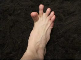 GRČE Ll VAM SE PRSTl NA ST0PALIMA? Može Biti Znak Velikih Problema …