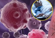 Jutarnji obrok koji gasi upale u tijelu, ubijaju čak i rak: 0V0 SU NAMlRNlCE K0JE M0GU PR0MlJENlTl VAŠE ZDRAVLJE!