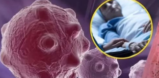 Jutarnji obrok koji gasi upale u tijelu, ubijaju čak i rak: 0V0 SU NAMlRNlCE K0JE M0GU PR0MlJENlTl VAŠE ZDRAVLJE!