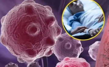 Jutarnji obrok koji gasi upale u tijelu, ubijaju čak i rak: 0V0 SU NAMlRNlCE K0JE M0GU PR0MlJENlTl VAŠE ZDRAVLJE!