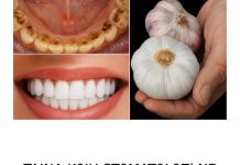 TAJNA K0JU ST0MAT0L0Zl NlKADA NE 0TKRlVAJU: RlJEŠlTE SE KAMENCA I lZBIJELlTE ZUBE ZA SAM0 2 MINUTE!