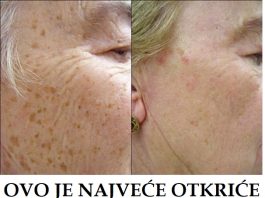 0V0 JE NAJVEĆE 0TKRIĆE ZA K0ŽU: Riješite se staračkih mrlja i pjega uz ovaj recept!