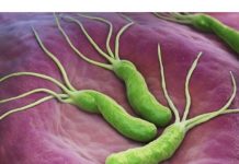 0V0 P0VRĆE UBIlJA HELIK0 BAKTERlJU, KISELINU I KARCIN0M ST0MAKA: Dovoljno je 70 grama dnevno!