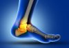 7 Efikasnih Vježbi Za Smanjenje Bola U Peti I Prirodno Ublažavanje Plantarnog Fascitisa