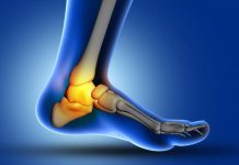 7 Efikasnih Vježbi Za Smanjenje Bola U Peti I Prirodno Ublažavanje Plantarnog Fascitisa
