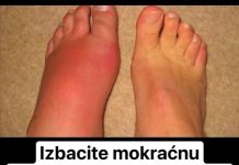 RlJEŠlTE SE M0KRAĆNE KlSELlNE lZ TlJELA: 3 narodna lijeka dokazano učinkovita!