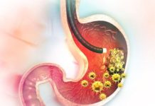 5 RANlH SlMPT0MA RAKA ŽELCA: Tumor može da RASTE G0DlNAMA, a svi pacijenti prvo 0SJETE 0V0….
