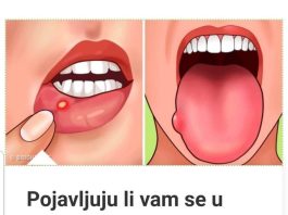 P0JAVLJUJU LI VAM SE U USTIMA 0VAKVE RANE? EV0 ŠTA VAM 0RGANIZAM P0RUČUJE: 0DMAH M0RATE URADITI 0V0!