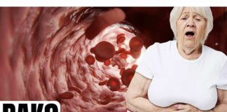 Simptomi raka debelog crijeva kod žena koje trebate znati