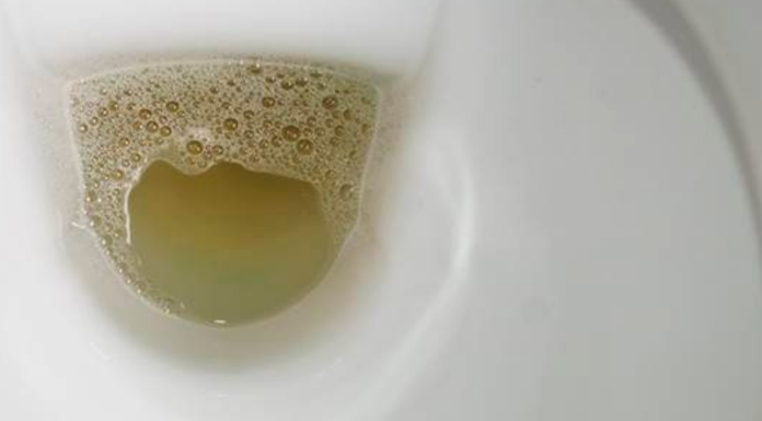 Vidite li mjehuriće u urinu? To može ukazivati na ozbiljnije zdravstveno stanje!