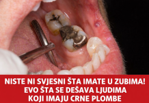 Niste ni svjesni šta imate u zubima! Evo šta se dešava ljudima koji imaju crne plombe (FOTO)